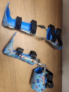 Limb Orthotics