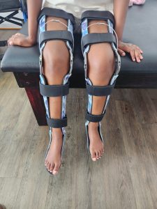 Limb orthotics for children